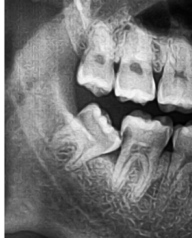 Oral Surgery services at Neua Dental